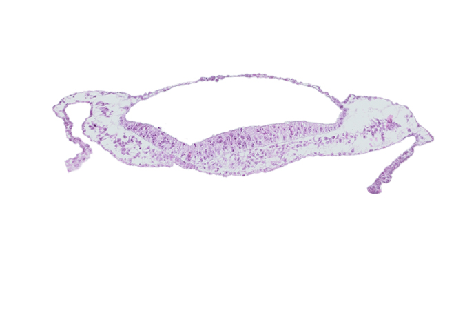 neural groove, prechordal plate