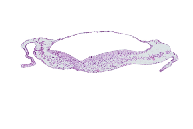 amnion, embryonic endoderm, extra-embryonic ectoderm, extra-embryonic endoderm, extra-embryonic mesoderm, neural groove, notochordal plate, umbilical vesicle attachment