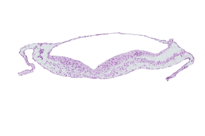 head mesenchyme, neural groove, notochordal plate