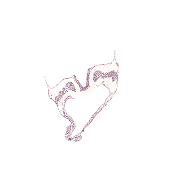 angioblastic tissue, artifact separation(s), caudal part of umbilical vesicle cavity, hindgut primordium (lumen), intermediate mesenchyme, lateral plate mesoderm, paraxial mesoderm