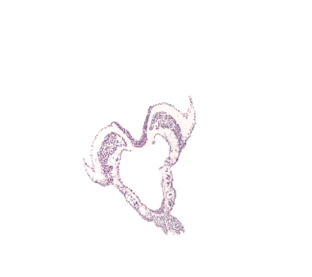 amnion attachment, artifact separation(s), endoderm, hindgut primordium (lumen), left umbilical artery, primordial left dorsal aorta, primordial right dorsal aorta