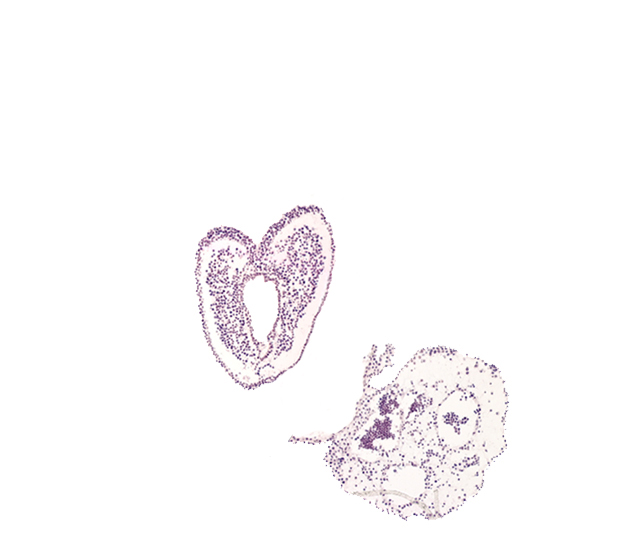 amnion attachment, amniotic cavity, common umbilical vein, connecting stalk, endoderm, gastrulation (primitive) groove, gastrulation (primitive) streak, mesoderm, ventral ectodermal ridge