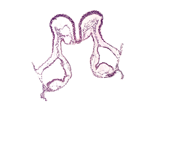 amniotic cavity, extra-embryonic endoderm, extra-embryonic mesoderm, mesencephalon primordium (M), midgut primordium (lumen), primordial left dorsal aorta, primordial pericardial cavity, umbilical vesicle angioblastic tissue, umbilical vesicle cavity