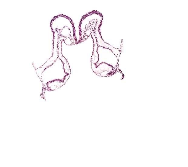 head mesenchyme, mesencephalon primordium (M), midgut primordium (lumen), presumptive left atrium, presumptive right atrium, primordial epimyocardium, primordial left dorsal aorta, primordial right dorsal aorta