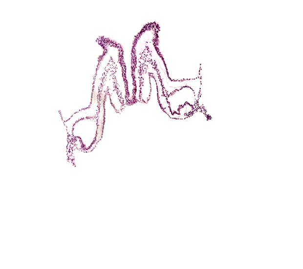 artifact separation(s), intra-embryonic coelom, midgut primordium (lumen), primordial left dorsal aorta, primordial neural crest (artifact separation), rhombencephalon primordium (R), umbilical vesicle cavity