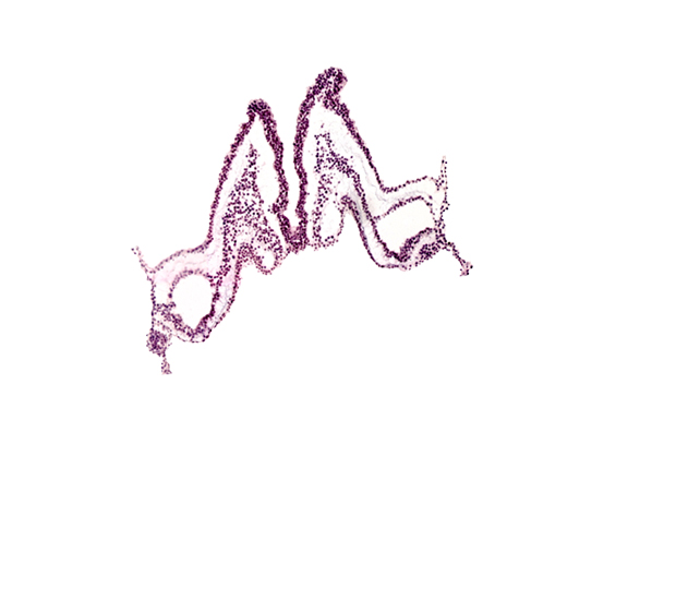 angioblastic tissue, head mesenchyme, primordial left dorsal aorta, rhombencephalon primordium (R), rhombomere B (Rh. B), rhombomere C (Rh. C), umbilical vesicle attachment