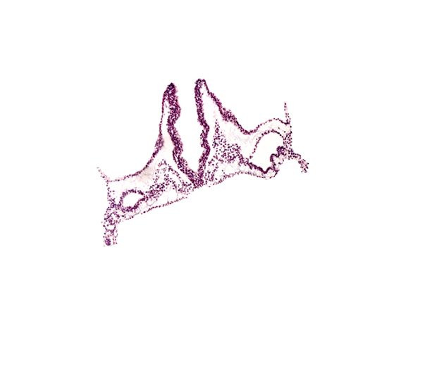extra-embryonic mesoderm, head mesenchyme, hemangioblastic tissue, notochordal plate, primordial otic placode, primordial right dorsal aorta, rhombomere A (Rh. A), rhombomere B (Rh. B), rhombomere C (Rh. C)