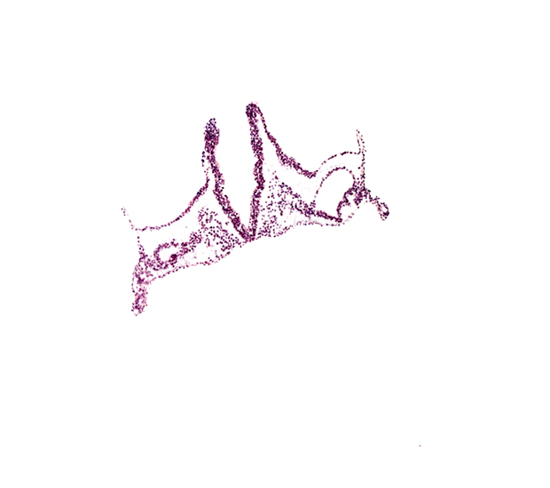 angioblastic tissue, intra-embryonic coelom, midgut primordium (lumen), notochordal plate, primordial otic placode, rhombencephalon primordium (R), rhombomere A (Rh. A), rhombomere B (Rh. B), rhombomere C (Rh. C)