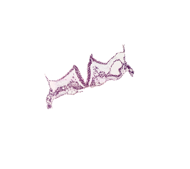 notochordal plate, primordial left dorsal aorta, primordial right dorsal aorta, rhombomere C (Rh. C), rhombomere D (Rh. D), somite 1 (O-1)