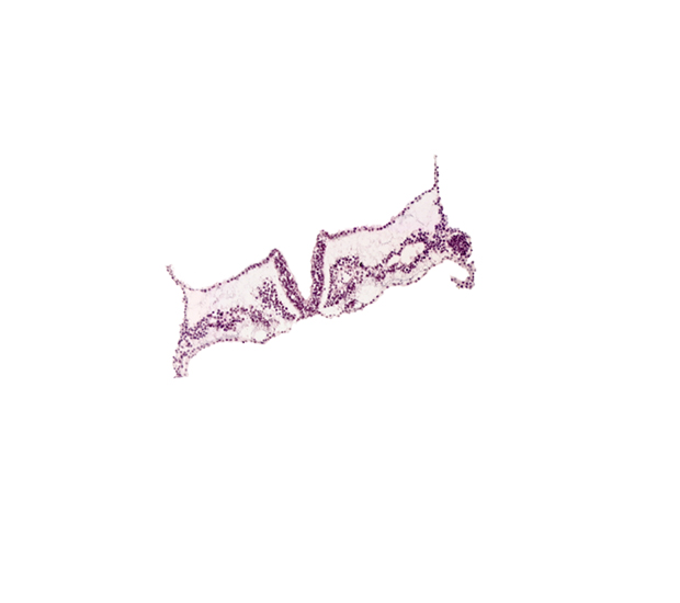 intermediate mesenchyme, left vitelline (omphalomesenteric) vein, rhombencephalon primordium (R), somite 1 (O-1), somitocoel 1, surface ectoderm, umbilical vesicle attachment