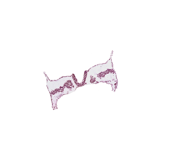 artifact separation(s), lateral plate mesoderm, paraxial mesoderm, primordial left dorsal aorta, primordial right dorsal aorta, spinal cord primordium, umbilical vesicle attachment