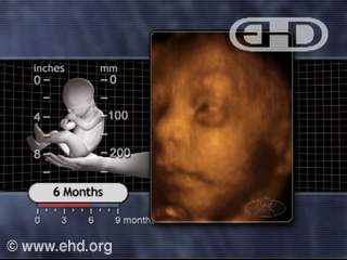 Play Movie - 6 months fetus, Blink-Startle Response