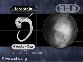 Rapid Brain Growth