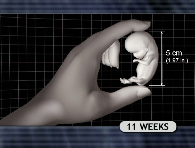 Prenatal Size References