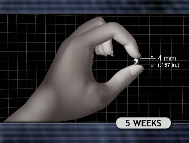 prenatal size references