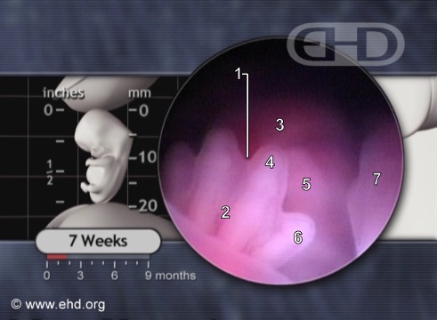 Hand, 7 Weeks Pregnant