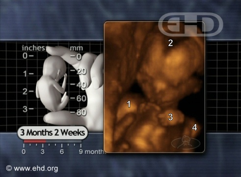 The 14-Week Fetus