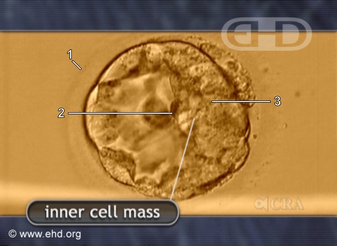 Blastocyst with Inner Cell Mass