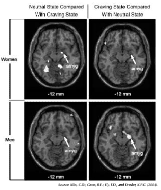 brain scan