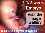 Visit the Image Gallery