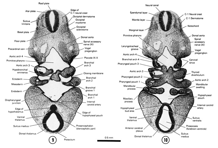 Open PDF version of FIG 5-10, A section through the cranial edge of the C-1 neural crest and the floor of the primitive pharynx. A section through the C-1 neural crest and the middle of the branchial arches and cervical sinus.