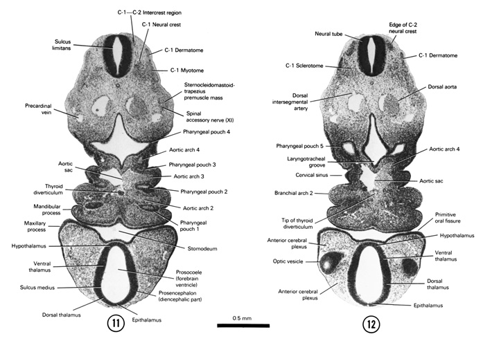 Open PDF version of FIG 5-11, A section through the C-1–C-2 intercrest region, thyroid diverticulum and aortic sac. A section through the edge of the C-2 neural crest and the edge of the optic vesicle.