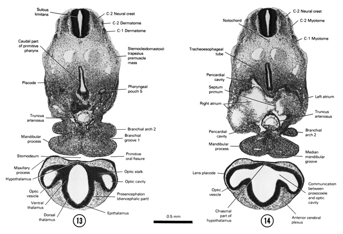 Open PDF version of FIG 5-12, A section through the C-2 neural crest, truncus arteriosus and the ventral part of branchial arches 1 and 2. A section through the C-2 neural crest, middle of the optic vesicle and cranial edge of the heart.