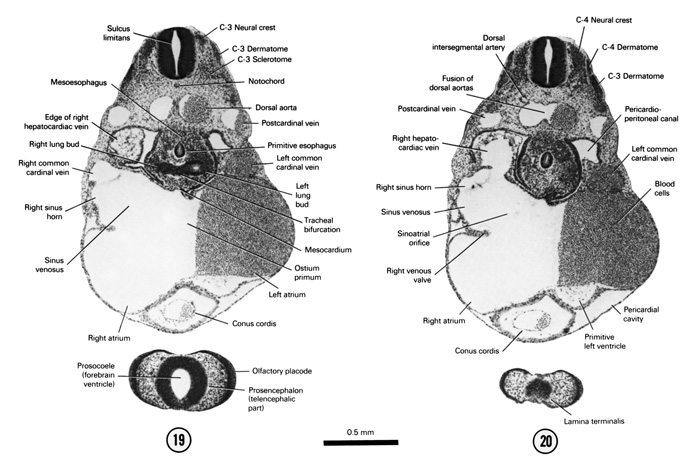 Open PDF version of FIG 5-15, A section through the C-3 neural crest and the tracheal bifurcation. A section through the C-4 neural crest and the cranial part of the primitive left ventricle.