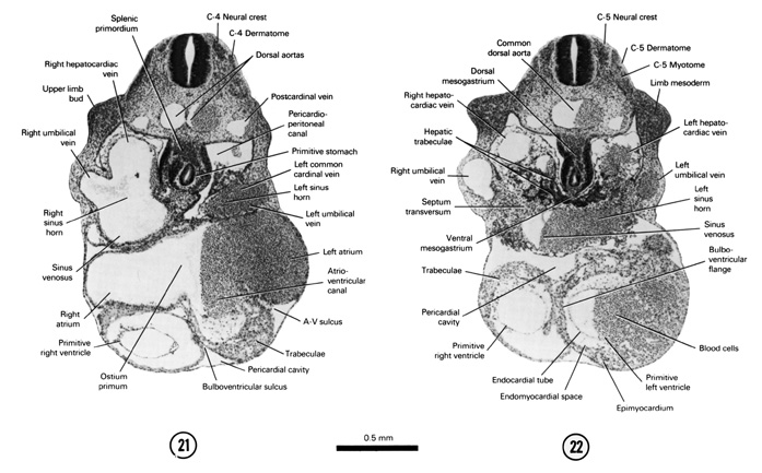 Open PDF version of FIG 5-16, A section through the C-4 neural crest, upper limb bud, primitive stomach and the horns of the sinus venosus. A section through the C-5 neural crest, cranial part of the hepatic trabeculae, septum transversum and upper limb bud. 