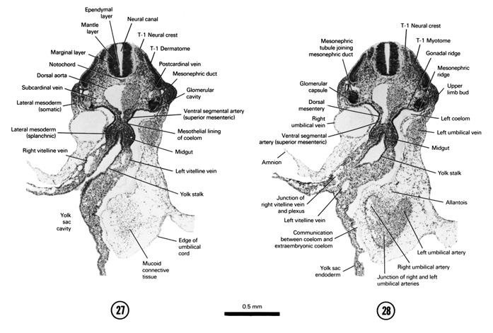 Open PDF version of FIG 5-19, A section through the T-1 neural crest, the yolk stalk and the cranial edge of the umbilical cord. A section through the T-1 neural crest and the middle of the midgut and yolk stalk junction.