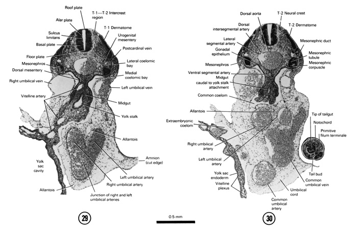 Open PDF version of FIG 5-20, A section through the T-1–T-2 intercrest region and the caudal part of the midgut and yolk stalk junction. A section through the T-2 neural crest and the tip of the tail bud.