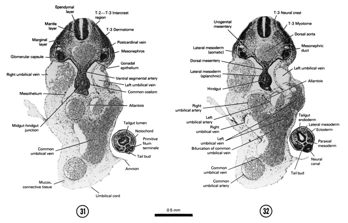 Open PDF version of FIG 5-21, A section through the T-2–T-3 intercrest region, the caudal tip of the notochord and the mid- and hindgut junction. A section through the T-3 neural crest and the cranial part of the hindgut.
