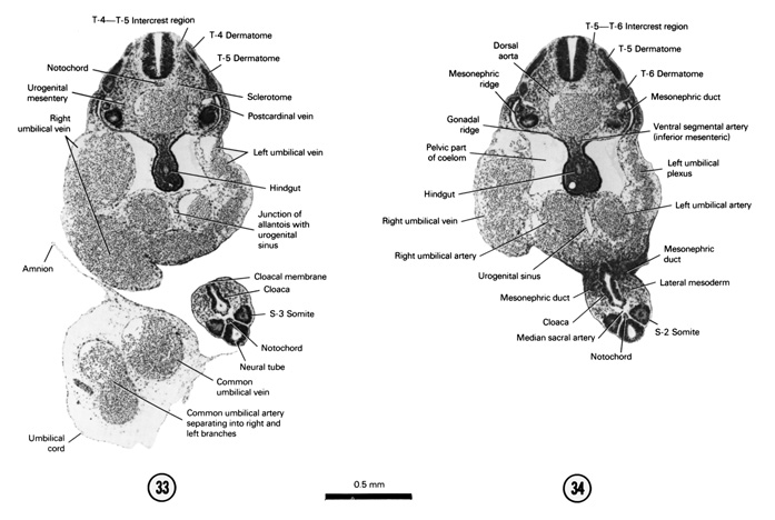 Open PDF version of FIG 5-22, A section through the T-4–T-5 intercrest region and the cloacal membrane at the level of the S-3 somite. A section through the T-5–T-6 intercrest region and the junction of the mesonephric ducts with the cloaca at the level of the S-2 somite.