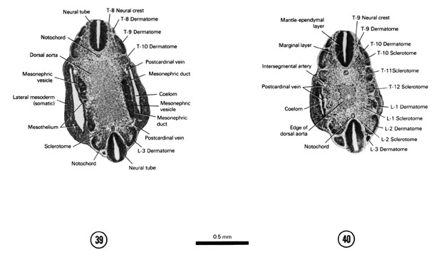 Open PDF version of FIG 5-25, A section through the T-8 neural crest, L-3 dermatome and caudal part of the coelom. A section through the T-9–L-3 dermatomes and the adjacent body wall.