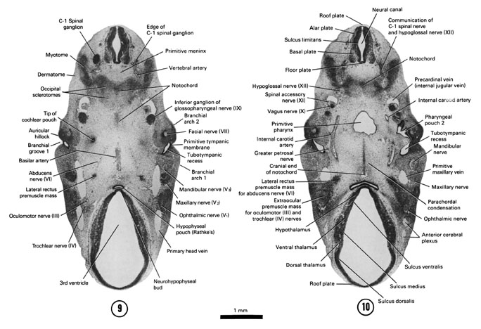 Open PDF version of FIG 6-10, A section through the junction of the hypophyseal pouch with the neurohypophyseal bud. A section through the cranial end of the notochord and edge of the primitive pharynx and internal carotid artery.