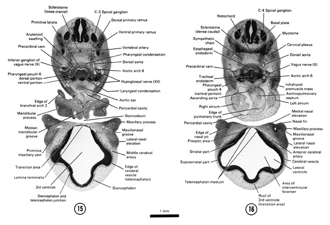Open PDF version of FIG 6-13, A section through the primitive larynx and fourth pharyngeal pouch. A section through the C-4 spinal ganglion and the cranial edge of the heart. 