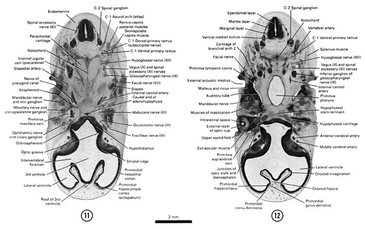 Open PDF version of FIG 7-11, A section through the C-2 spinal ganglion. A section through the dorsal edge of the optic cup and primitive pharynx.