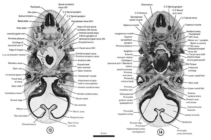 Open PDF version of FIG 7-12, A section through the C-3 spinal ganglion and the junction of the auditory tube (first pouch) with the primitive pharynx. A section through palatine fossa (second pouch) and the primitive oral cavity. 