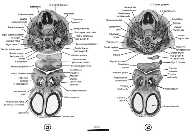 Open PDF version of FIG 7-16, A section through the greater thymic bud (third pouch) and the isthmus of the thyroid gland. A section through the C-7 spinal ganglion and clavicle.