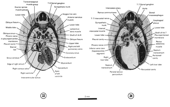 Open PDF version of FIG 7-22, A section through the T-6 spinal ganglion and caudal edge of the ventricles. A section through the T-7 spinal ganglion and the cranial edge of the liver.