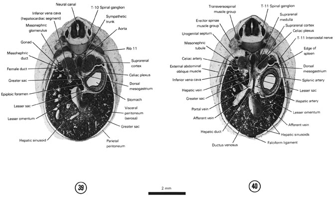 Open PDF version of FIG 7-25, A section through the epiploic foramen. A section through the T-11 spinal ganglion and the cranial edge of the spleen.