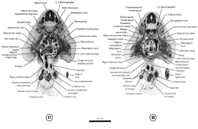 Open PDF version of FIG 7-29, A section through the aortic bifurcation and the bladder portion of the urogenital sinus. A section through the L-3 spinal ganglion and the caudal edge of the metanephros.