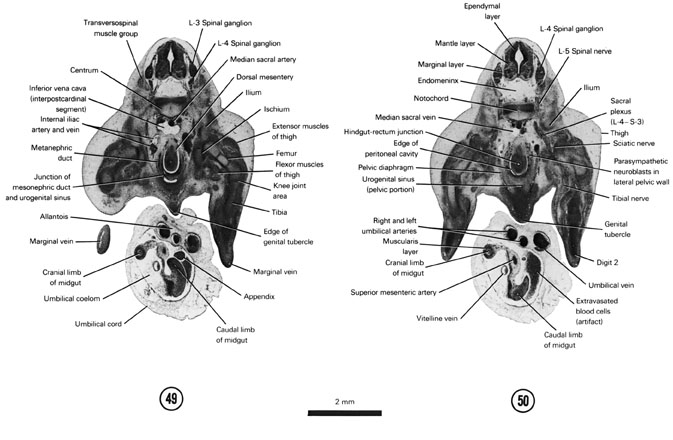 Open PDF version of FIG 7-30, A section through the L-4 spinal ganglion and the cranial edge of the genital tubercle. A section through the pelvic portion of the urogenital sinus and the caudal edge of the peritoneal cavity.