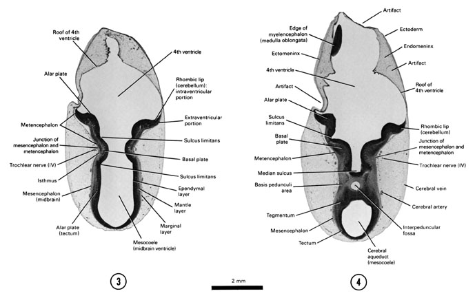 Open PDF version of FIG 7-7, A section through the middle of the mes- and metencephalon junction. A section through the ventral part of the mes- and metencephalon junction and edge of the myelencephalon.