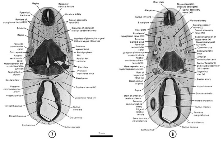 Open PDF version of FIG 7-9, A section through the met- and myelencephalon junction. A section through the edge of the cerebral vesicle and basal portion of the pons area.