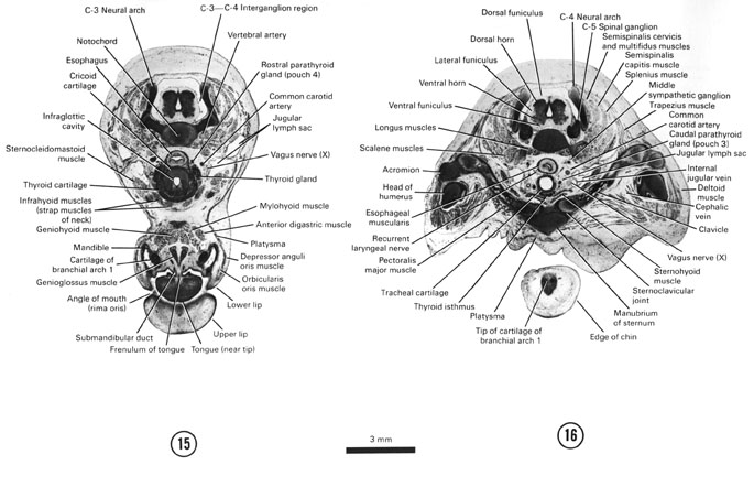 Open PDF version of FIG 8-10, A section through the angle of the mouth, tongue tip and beginning of the esophagus. A section through the edge of the chin, manubrium of the sternum and C-5 spinal ganglion.