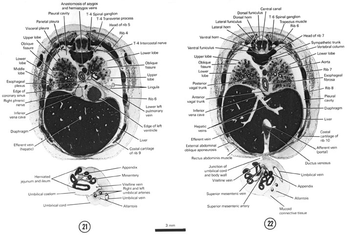Open PDF version of FIG 8-13, A section through the umbilical cord, caudal edge of the heart and the T-4 spinal ganglion. A section through the junction of the umbilical cord and the body wall and the T-6 spinal ganglion.
