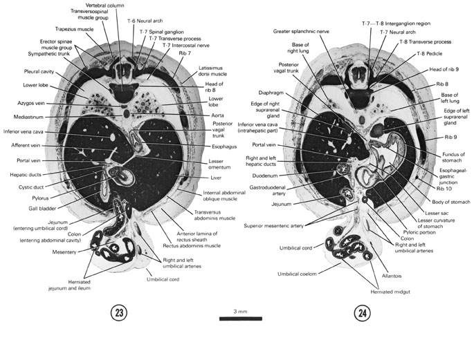 Open PDF version of FIG 8-14, A section through the gall bladder, pylorus and T-7 spinal ganglion.