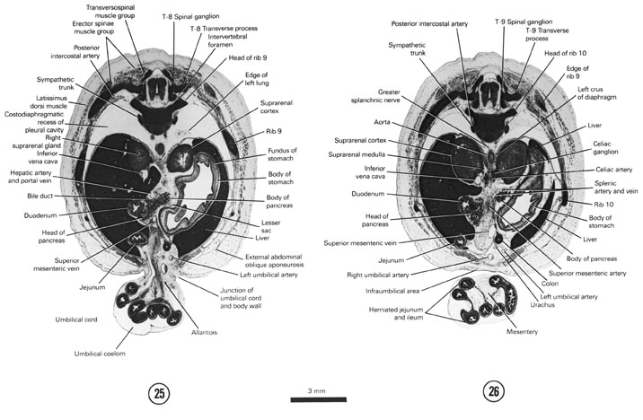 Open PDF version of FIG 8-15, A section through the pancreas, caudal edge of the lung and T-8 spinal ganglion. A section through the celiac and T-9 spinal ganglia. 