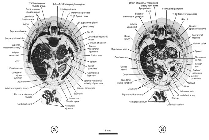 Open PDF version of FIG 8-16, A section through the duodenal-jejunal junction, spleen and T-9–T-10 interganglion region. A section through the cranial edge of the gonads, renal hilum and T-10 spinal ganglion. 